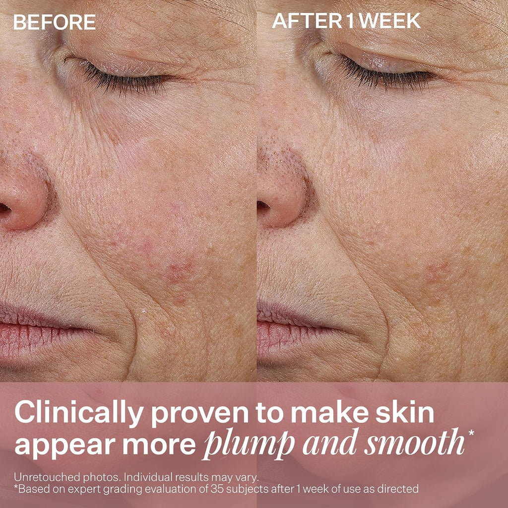 StriVectin Anti-Wrinkle Peptide Plump Line Filling Bounce Face Serum with Ceramides & Peptides for Firm Skin and Less Wrinkles & Fine Lines