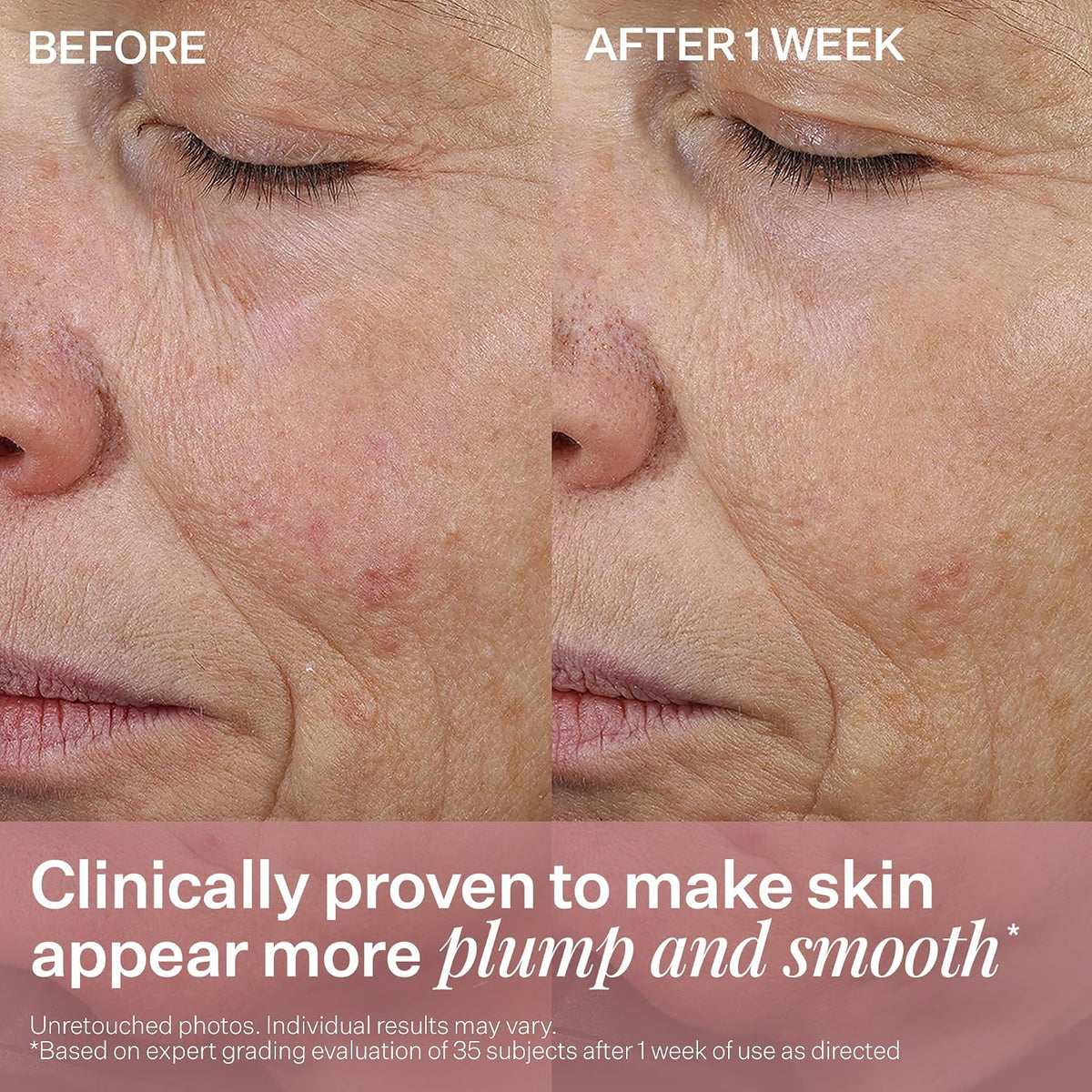 StriVectin Anti-Wrinkle Peptide Plump Line Filling Bounce Face Serum with Ceramides & Peptides for Firm Skin and Less Wrinkles & Fine Lines